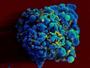 HIV T cell
